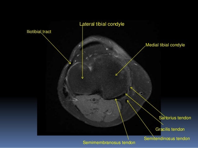 Mri Master Pdf